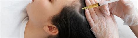 Stem Cell Hair Treatment | Houston Regenerative Medicine