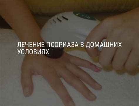 Лечение псориаза в домашних условиях: кремы и мази от псориаза ...