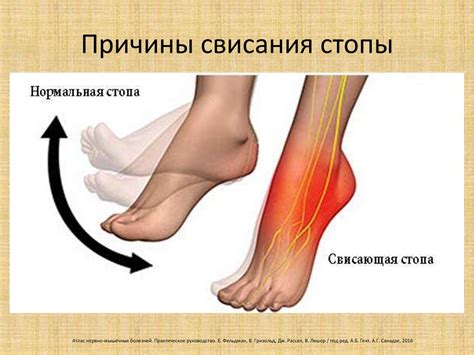 Неврологический подход к болям в стопе разной этиологии - презентация ...