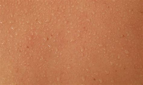 Sweaty Skin Texture Stock Photos, Pictures & Royalty-Free Images - iStock
