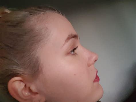 Post partum hair loss has got me down. : r/Hair