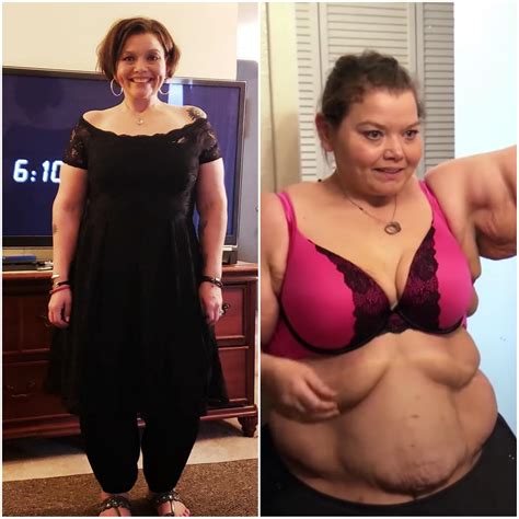 'My 600 lb Life' Success Stories: Incredible Before and Afters