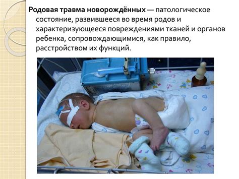 Родовая травма новорожденного (кефалогематома и родовая опухоль ...
