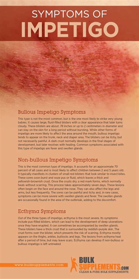 Impetigo: Symptoms, Causes & Treatment