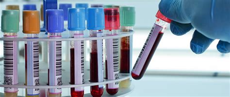 What Is the Function of Anti-Müllerian hormone (AMH)?