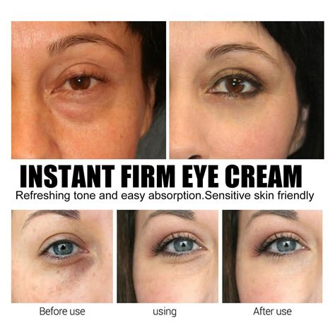 Hoygi Eye Cream for Brightening and Tightening Skin around Eyes