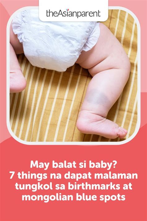 na  malaman tungkol sa birthmarks  mongolian blue spots