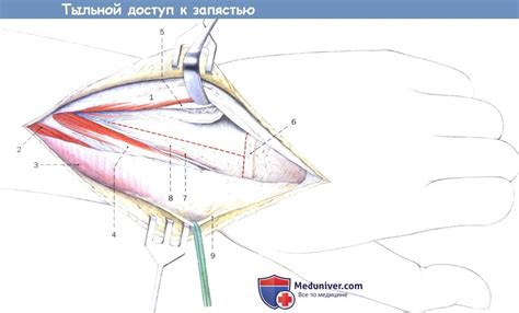 Техника тыльного доступа к запястью и лучезапястному суставу