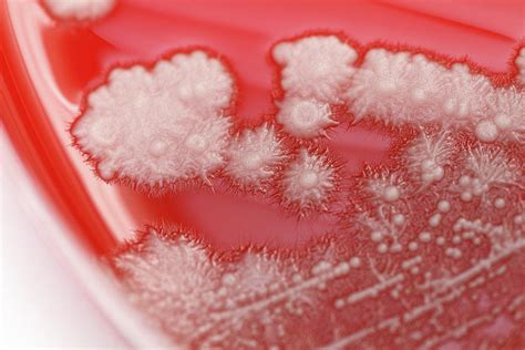 Candida: 20 Myths Patients Believe