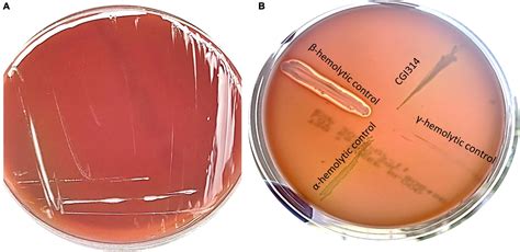 Bacillus Coagulans Assessment – Kankerala