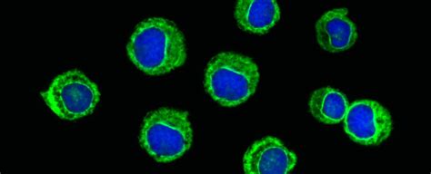 New Drug Causes Cancer to "Melt Away" in Patients With Advanced ...