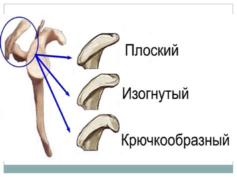 Импинджмент синдром - online presentation