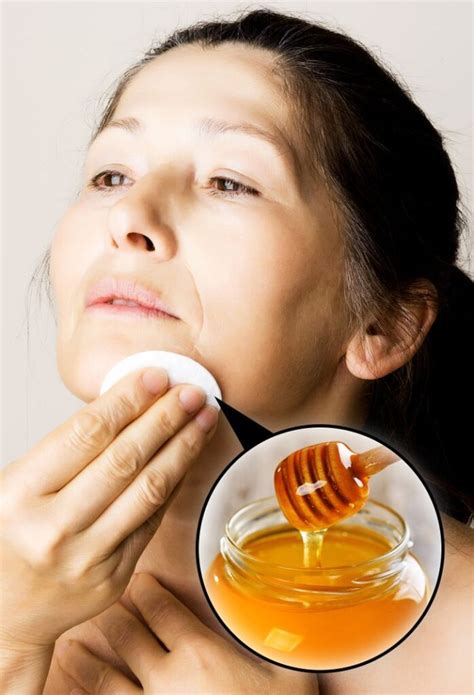 6 Home Remedies To Get Rid Of Warts Naturally You Can Try Today