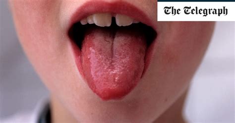 Strep A: What are the symptoms and how infectious is it?