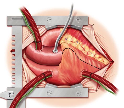 Heart surgery on Behance