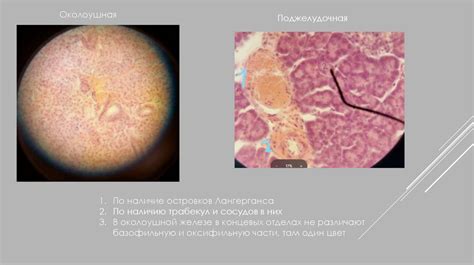 Поджелудочная железа - презентация онлайн