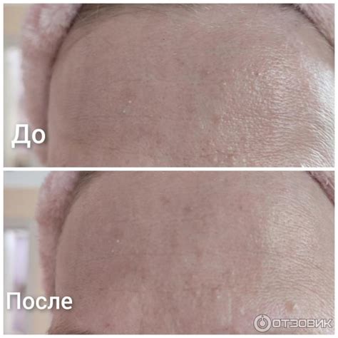 Отзыв о Скраб пробиотический для лица БакЗдрав ProBioDerm | Скраб с ...
