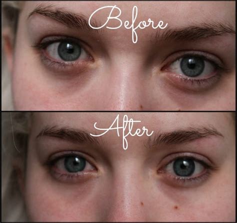 Can These Contact Lenses Make Your Eyes Sparkle? Eye Provide Review
