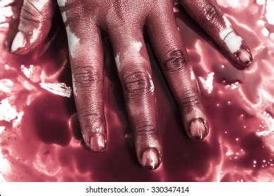 bloody finger images stock  vectors shutterstock