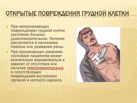 Ушибы и сотрясение, сдавление грудной клетки и - online presentation