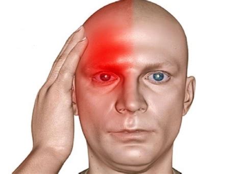 Жжение в висках: причина жжения в правом или левом виске