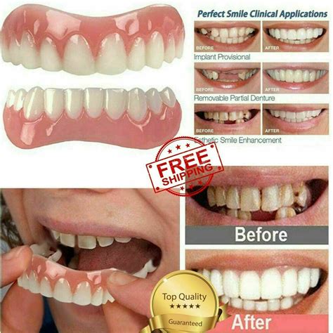 Magic Brace Temporary Smile Comfort Teeth Cosmetic Easy To Install