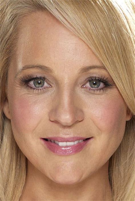 UV-Strahlung: Der UV-Scanner zeigt Hautschäden.