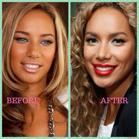 Jennifer Lopez Plastic Surgery Photos [Before & After] - Surgery4