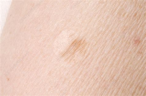 Mole - Stock Image - M220/0199 - Science Photo Library