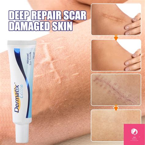 contractubex scar gel original Australia Dermatix Scar Gel Acne Scars ...
