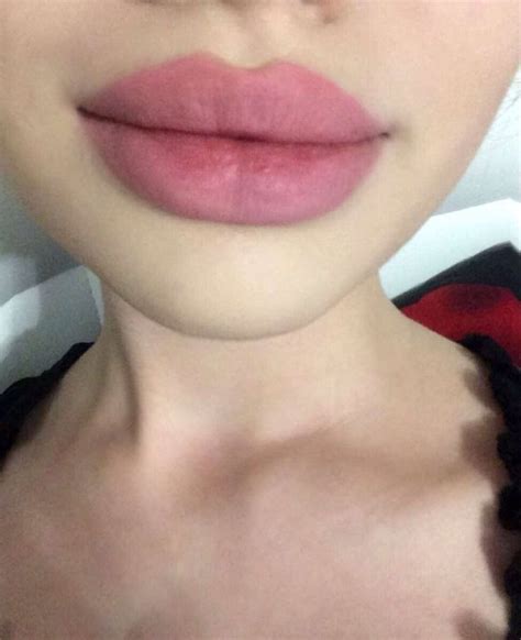 °Сохры° | Lips inspiration, Botox lips, Lip fillers