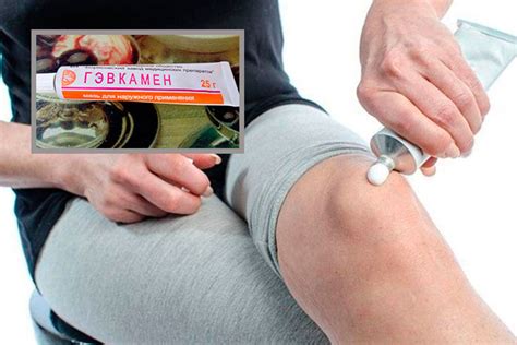 Гэвкамен: мазь – от чего, инструкция по применению, цена, для чего ...