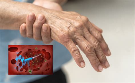 toxic shock syndrome  symptoms  treatment