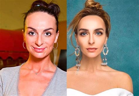 Екатерина Варна 30 фото До и После пластики – Скачать бесплатно