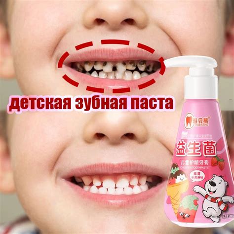 Детская зубная паста для чувствительных зубов от кариеса и налета на ...