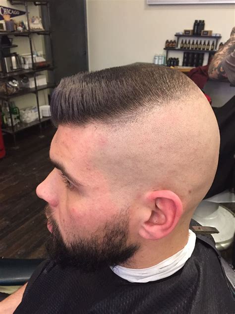 This specific short back and sides long on top cut hides balding 2