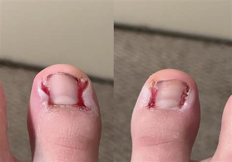 Do these look like they’re healing okay? Got all 4 sides done the 19th