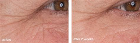 Dynamic Skin Retinol Serum – Dermalogica UK