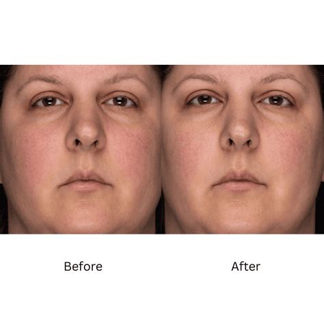 ZO® Overnight Recovery Creme - Advanced Dermatology and Cosmetic Surgery