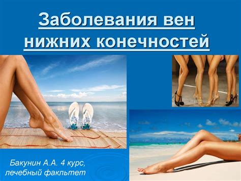 Заболевания вен нижних конечностей - online presentation