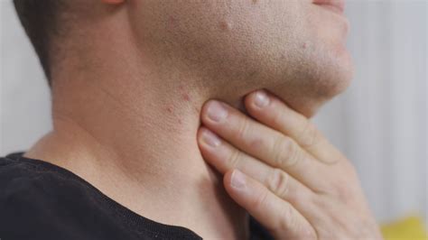 Throat ache. Sick man. The man with the goiter. Man holding his throat