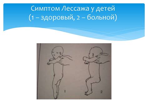 Менингит. Классификация - презентация онлайн