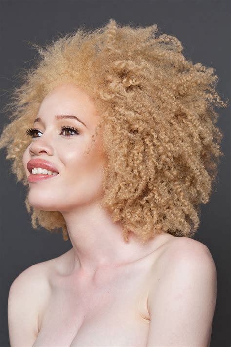 Unique Beauty Of Albino People | DeMilked