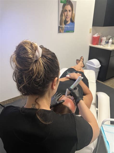 Platelet Rich Plasma (PRP) - Aesthetic Beauty Lounge