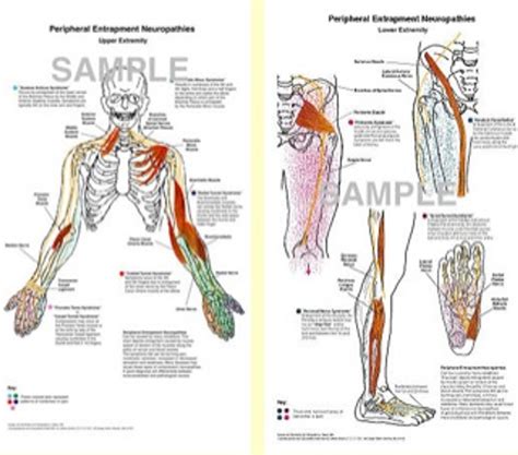 Peripheral Entrapment Neurapathy Charts