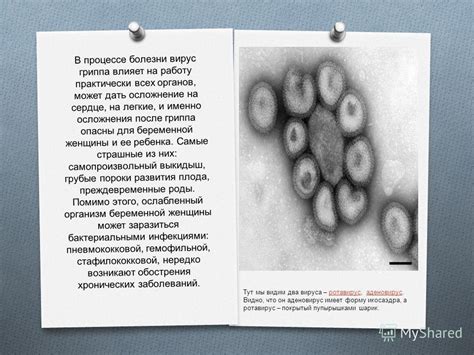 Презентация на тему: "Влияние гриппа в период беременности. Опасный ...