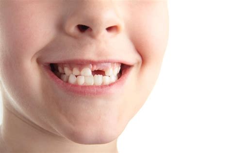 Dientes de leche - BUCAL.ORG