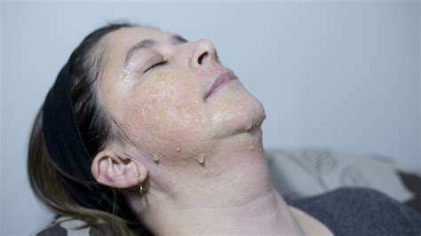 4 Ways to Make a Facial Peel - wikiHow