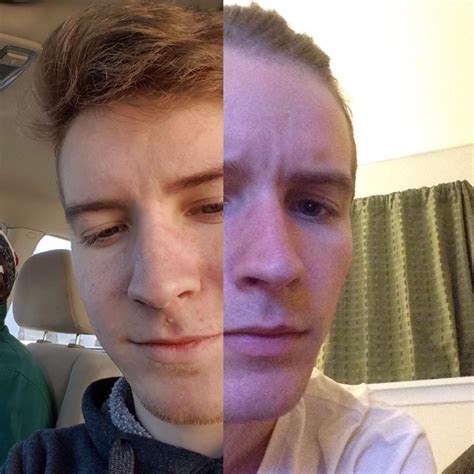 face is puffy in the morning 4