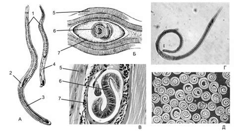 Трихинелла (Trichinella spiralis)